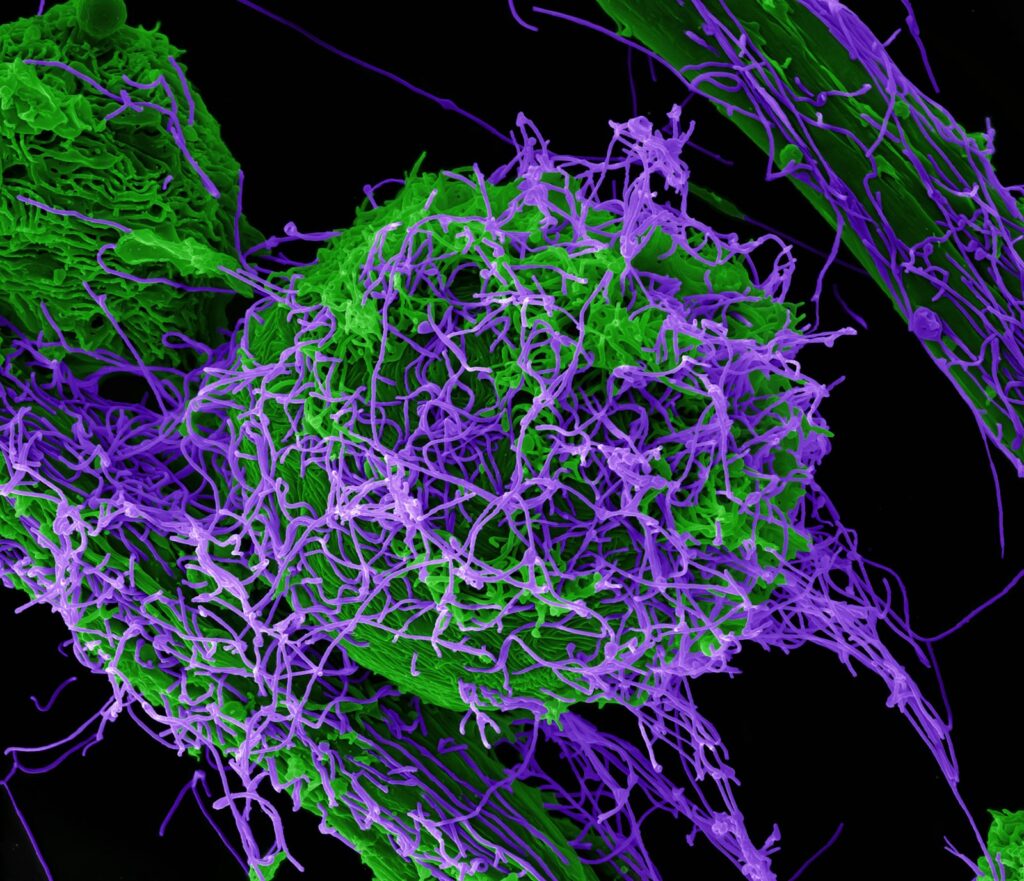 A colourised micrograph of purple Ebola virus particles budding from green infected cells