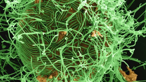 A colourised electron micrograph of thread-like Ebola virus particles on an infected cell